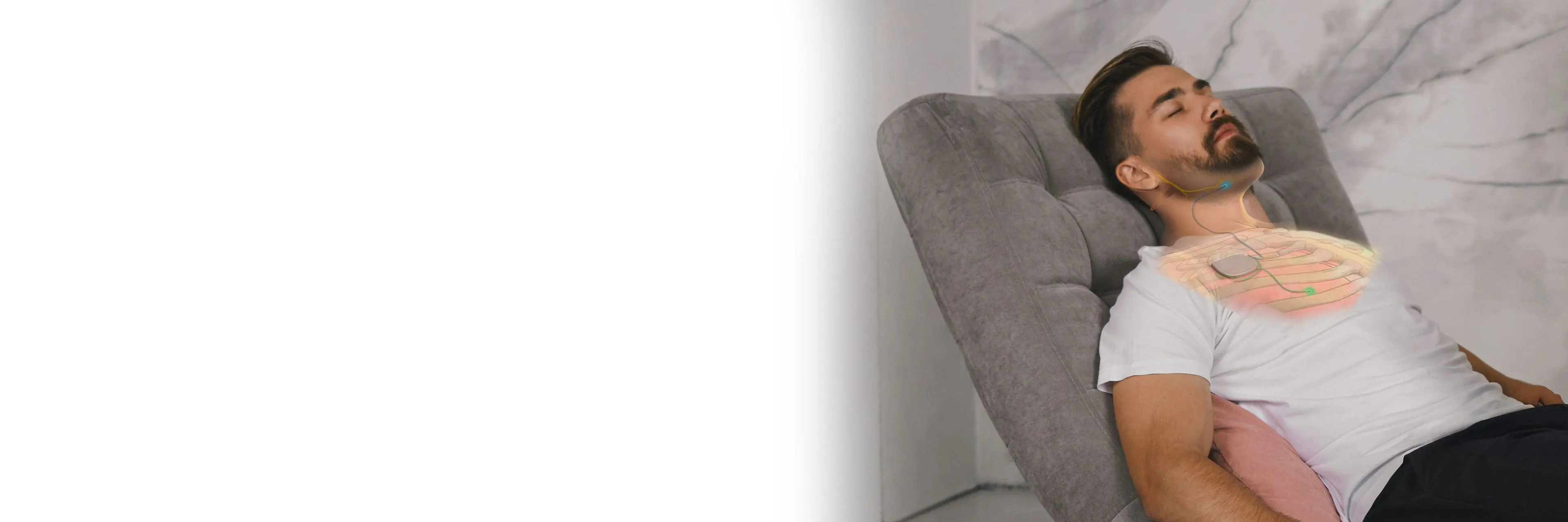 hypoglossal nerve stimulation hgns treatment